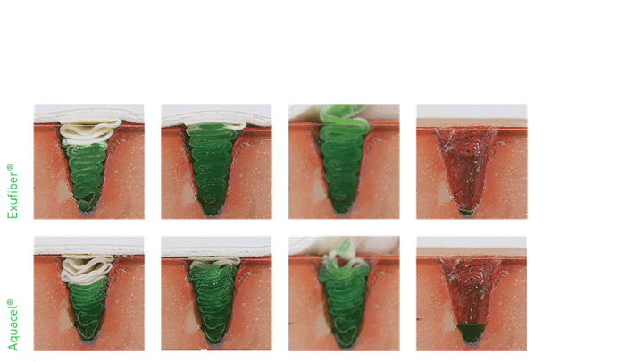 exufiber compared to aquacel